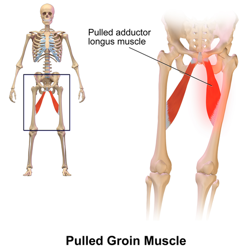 Why Do Squats Hurt My Groin?